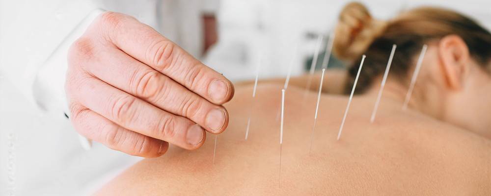 Acupuncture en auvergne-Alain Bayard